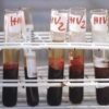 Salute, da Hiv a infezioni sessuali lotta a sommerso, al via settimana europea test