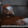Hamas diffonde video dell’ostaggio Maxim Herkin ferito: “Colpito dalle Idf in un tunnel”