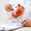 Cancro allo stomaco avanzato, nuova terapia riduce del 42% il rischio di morte ﻿